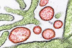 nipah virus under the microscope