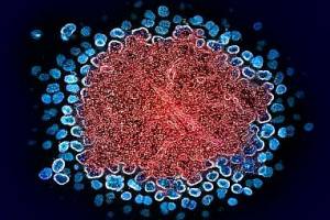 HIV vaccine candidate