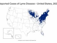 Lyme disease vaccine
