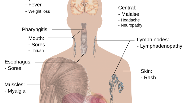 HIV vaccines April 2023